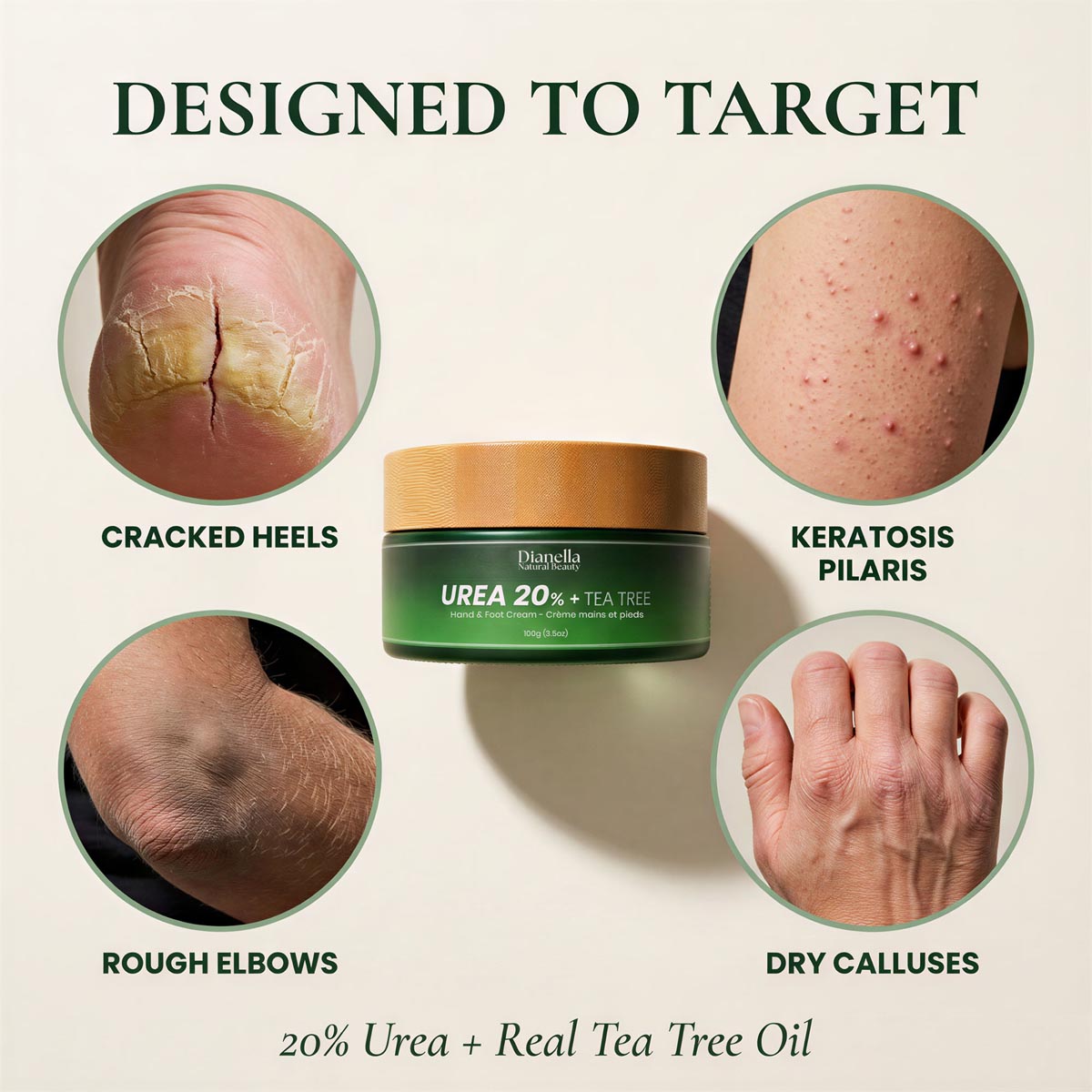 Urea 20% + Tea Tree ‎ ‎ ‎ ‎ Hand & Foot Cream
