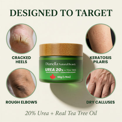Urea 20% + Tea Tree ‎ ‎ ‎‎‎ ‎‎‎ ‎ ‎Hand & Foot Cream