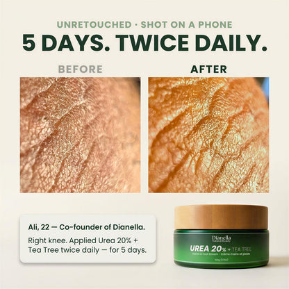 Urea 20% + Tea Tree ‎ ‎ ‎ ‎ Hand & Foot Cream