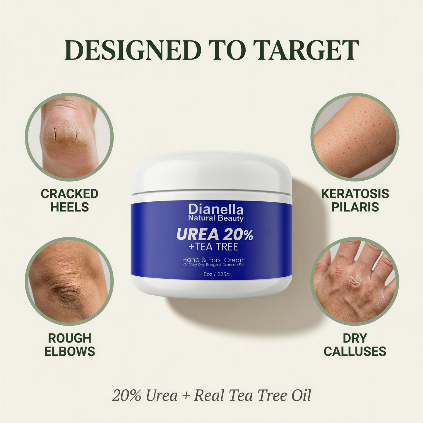 Urea 20% + Tea Tree Hand & Foot Cream for Dry, Cracked Skin - 8oz