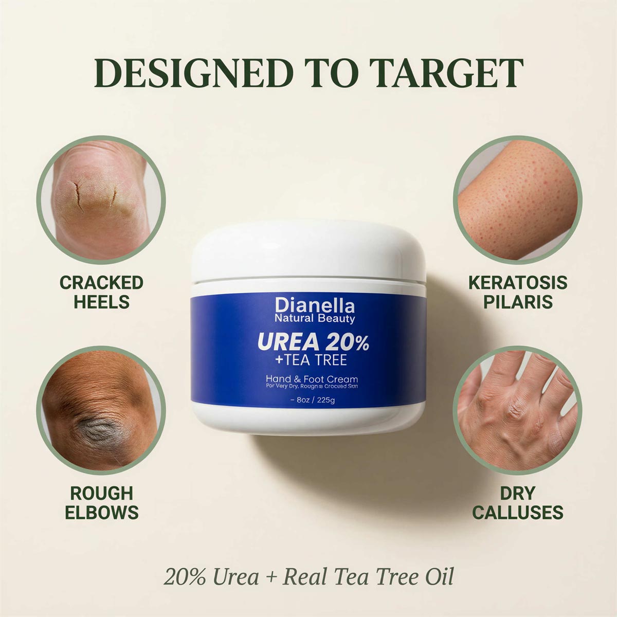 Urea 20% + Tea Tree ‎ ‎ ‎ ‎ Hand & Foot Cream 8oz